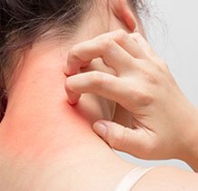 View More Details About Skin Allergy - Get Accurate Skin Allergy Tests From Jerath Path Labs